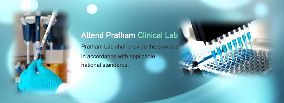 Best clinical laboratory in chandigarh