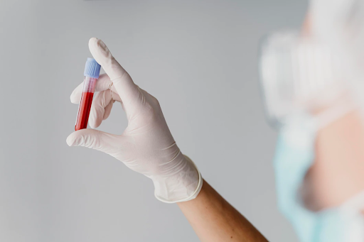 Blood Test Laboratory in Chandigarh